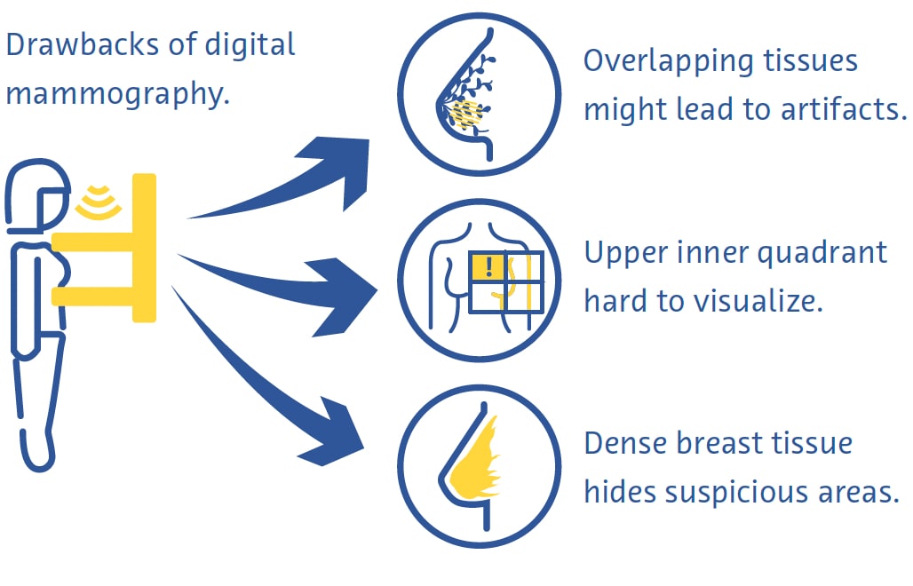 Drawbacks of Digital mammography Drawbacks of Digital mammography