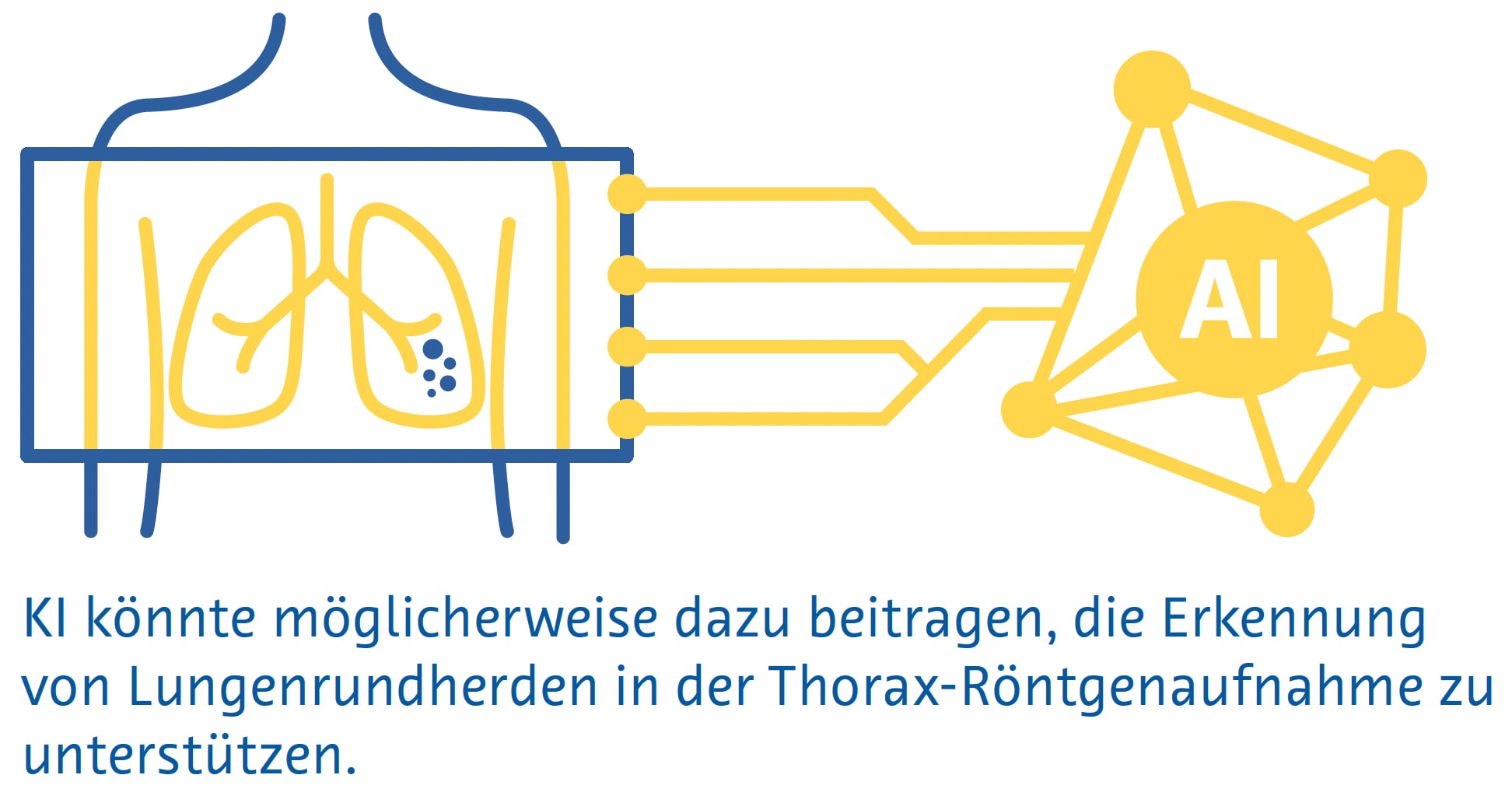 Erkennung von Lungenrundherden Erkennung von Lungenrundherden