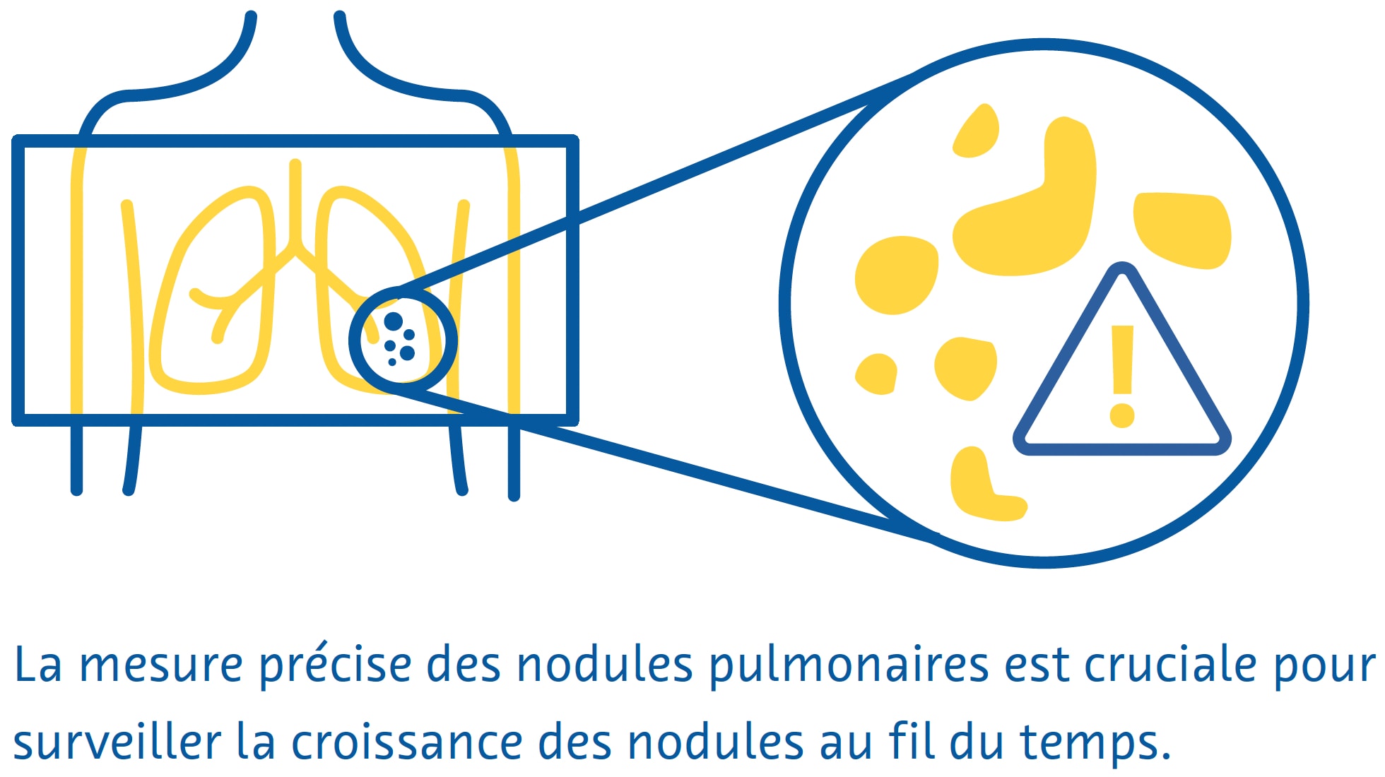 des-nodules des-nodules