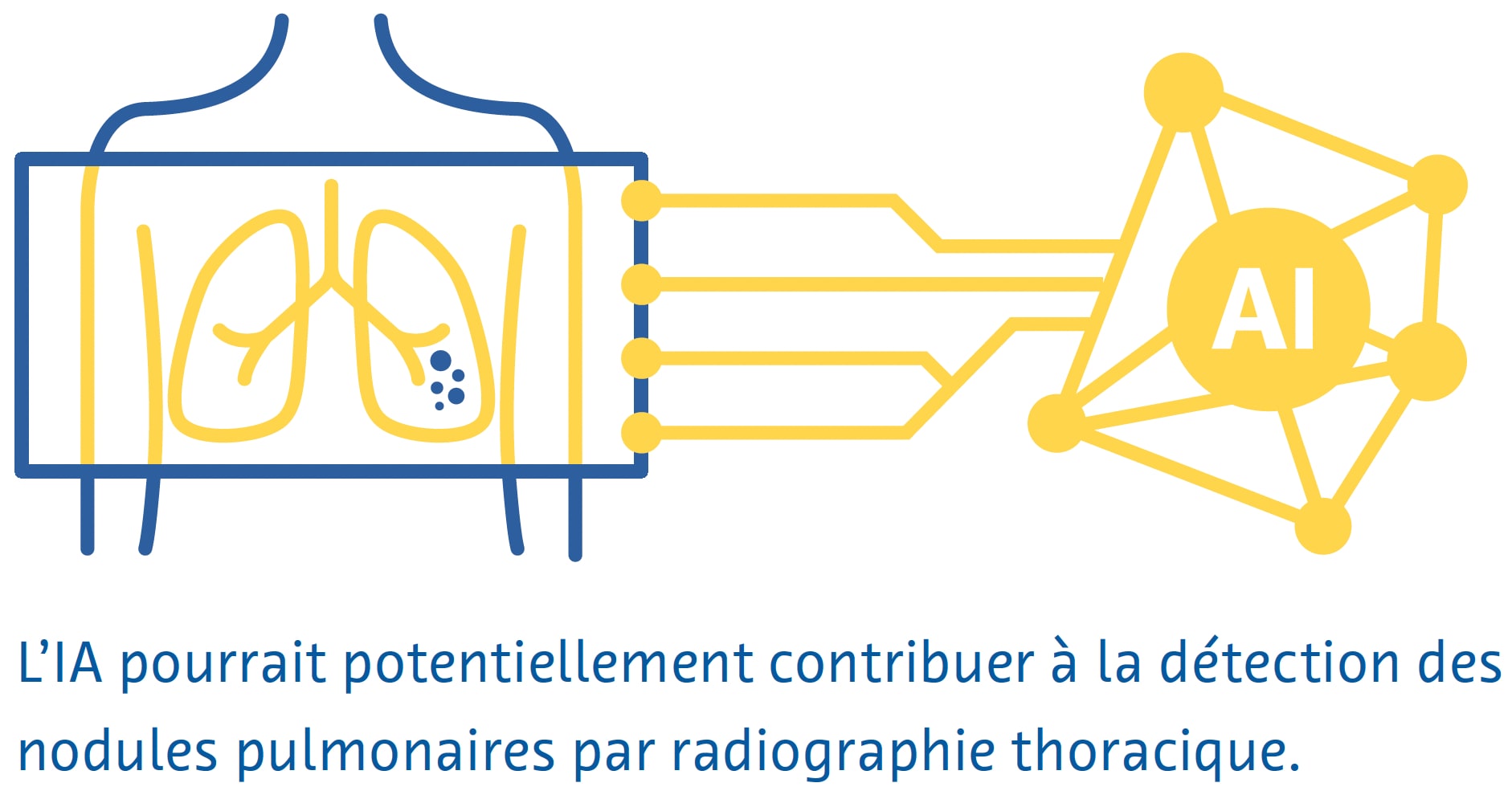 radiographie-thoracique radiographie-thoracique